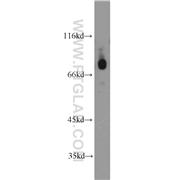 CTCFL Rabbit Polyclonal Antibody (11074-2-AP)
