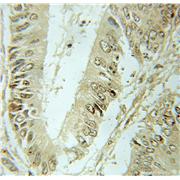 SF3B2 Rabbit Polyclonal Antibody (10919-1-AP)