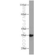 SULT1C2 Rabbit Polyclonal Antibody (10662-1-AP)
