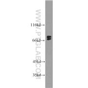 BLNK Rabbit Polyclonal Antibody (10855-1-AP)