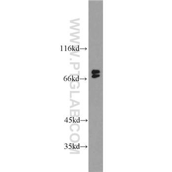 BLNK Rabbit Polyclonal Antibody (10855-1-AP)