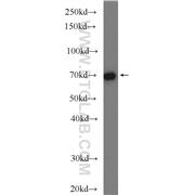 CUL3 Rabbit Polyclonal Antibody (11107-1-AP)