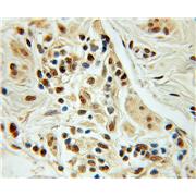 NUDT11 Rabbit Polyclonal Antibody (10912-1-AP)