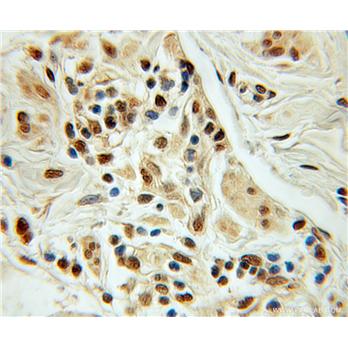 NUDT11 Rabbit Polyclonal Antibody (10912-1-AP)