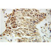 LSM4 Rabbit Polyclonal Antibody (10834-1-AP)