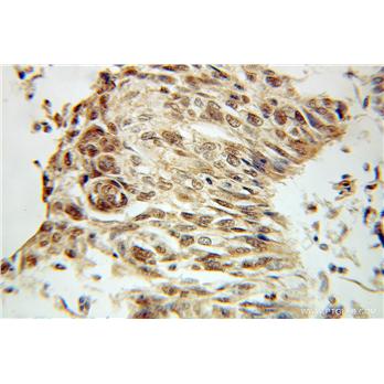 LSM4 Rabbit Polyclonal Antibody (10834-1-AP)
