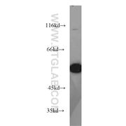 SESN2 Rabbit Polyclonal Antibody (10795-1-AP)