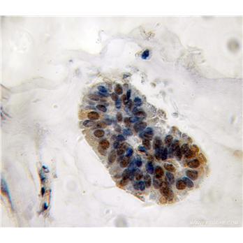 MPHOSPH6 Rabbit Polyclonal Antibody (10695-1-AP)