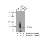 SDC3 Rabbit Polyclonal Antibody (10886-1-AP)