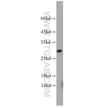 RAB3C Rabbit Polyclonal Antibody (10788-1-AP)