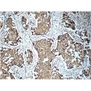 TIMP3 Rabbit Polyclonal Antibody (10858-1-AP)