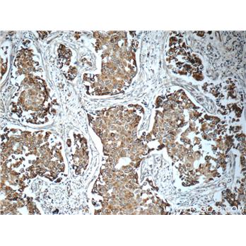 TIMP3 Rabbit Polyclonal Antibody (10858-1-AP)