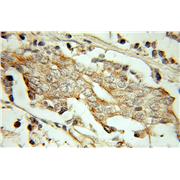 PSMG2 Rabbit Polyclonal Antibody (10959-1-AP)