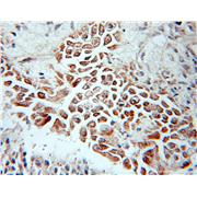 UBE2B Rabbit Polyclonal Antibody (10733-1-AP)