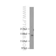 PARD3 Rabbit Polyclonal Antibody (11085-1-AP)