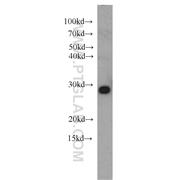 NIPSNAP3A Rabbit Polyclonal Antibody (10751-1-AP)