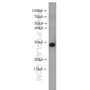 NIPSNAP3A Rabbit Polyclonal Antibody (10751-1-AP)