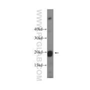 APOBEC3C Rabbit Polyclonal Antibody (10591-1-AP)