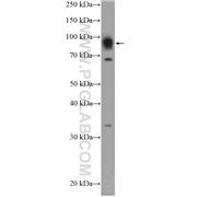 DACH1 Rabbit Polyclonal Antibody (10914-1-AP)