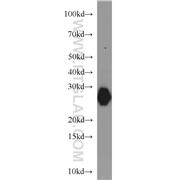 MYL3 Rabbit Polyclonal Antibody (10913-1-AP)