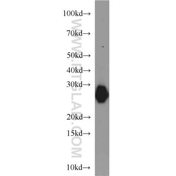 MYL3 Rabbit Polyclonal Antibody (10913-1-AP)