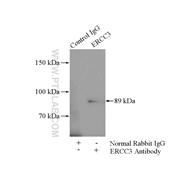 ERCC3 Rabbit Polyclonal Antibody (10580-1-AP)
