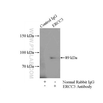 ERCC3 Rabbit Polyclonal Antibody (10580-1-AP)