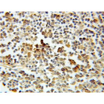 ASF1A Rabbit Polyclonal Antibody (10784-1-AP)