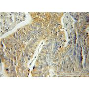 SH3BP5 Rabbit Polyclonal Antibody (11127-2-AP)