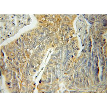 SH3BP5 Rabbit Polyclonal Antibody (11127-2-AP)