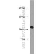 RBM15 Rabbit Polyclonal Antibody (10587-1-AP)