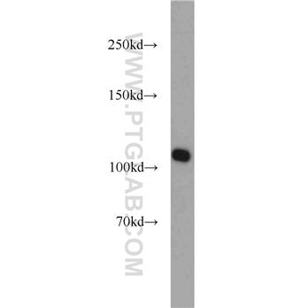 RBM15 Rabbit Polyclonal Antibody (10587-1-AP)