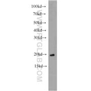 ARL3 Rabbit Polyclonal Antibody (10961-1-AP)