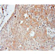 IL32 Rabbit Polyclonal Antibody (11079-1-AP)