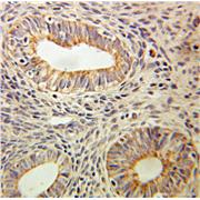 CD59 Rabbit Polyclonal Antibody (10742-1-AP)