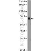 ETFDH Rabbit Polyclonal Antibody (11109-1-AP)