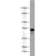 NOL3 Rabbit Polyclonal Antibody (10846-2-AP)