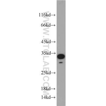 NOL3 Rabbit Polyclonal Antibody (10846-2-AP)