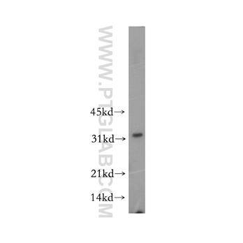AKR7A2 Rabbit Polyclonal Antibody (10730-1-AP)