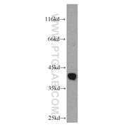 ADH5 Rabbit Polyclonal Antibody (11051-1-AP)