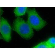 PALLD Rabbit Polyclonal Antibody (10853-1-AP)