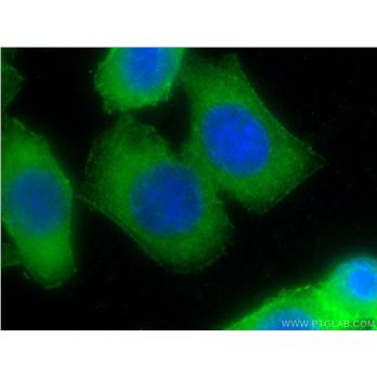 PALLD Rabbit Polyclonal Antibody (10853-1-AP)