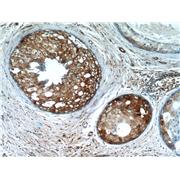 MGP Rabbit Polyclonal Antibody (10734-1-AP)