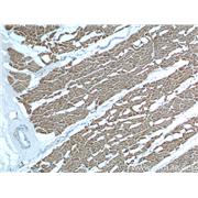 MYL2 Rabbit Polyclonal Antibody (10906-1-AP)