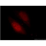 PITX1 Rabbit Polyclonal Antibody (10873-1-AP)