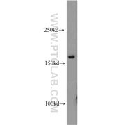 CPSF1 Rabbit Polyclonal Antibody (11031-1-AP)