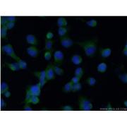 HMOX1 Rabbit Polyclonal Antibody (10701-1-AP)