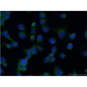 HMOX1 Rabbit Polyclonal Antibody (10701-1-AP)