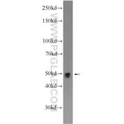 CDC23 Rabbit Polyclonal Antibody (10683-1-AP)