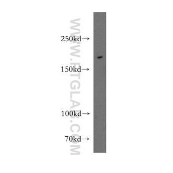 ENG Rabbit Polyclonal Antibody (10862-1-AP)